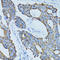 ADAM Metallopeptidase With Thrombospondin Type 1 Motif 4 antibody, LS-C332140, Lifespan Biosciences, Immunohistochemistry paraffin image 