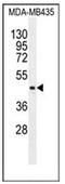 Lipase Family Member K antibody, AP52497PU-N, Origene, Western Blot image 