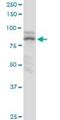 Zinc Finger Protein 624 antibody, H00057547-B01P, Novus Biologicals, Western Blot image 