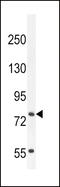 Solute Carrier Organic Anion Transporter Family Member 4C1 antibody, 56-045, ProSci, Western Blot image 