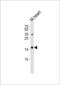 Natriuretic Peptide A antibody, LS-B9895, Lifespan Biosciences, Western Blot image 