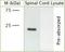 Ras Homolog Family Member A antibody, NB100-91273, Novus Biologicals, Western Blot image 