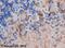 Insulin Receptor Substrate 2 antibody, ab3690, Abcam, Immunohistochemistry paraffin image 