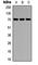 Protein Phosphatase 2 Regulatory Subunit B'Delta antibody, abx121668, Abbexa, Western Blot image 