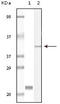 Calcium And Integrin Binding 1 antibody, M01797, Boster Biological Technology, Western Blot image 