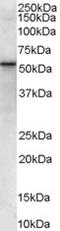 Vacuolar Protein Sorting 45 Homolog antibody, TA303041, Origene, Western Blot image 