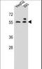 ZFP91 Zinc Finger Protein antibody, LS-B10151, Lifespan Biosciences, Western Blot image 