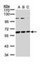 Basic, Immunoglobulin-Like Variable Motif Containing antibody, GTX110496, GeneTex, Western Blot image 