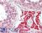 Farnesyl-Diphosphate Farnesyltransferase 1 antibody, LS-B15234, Lifespan Biosciences, Immunohistochemistry paraffin image 