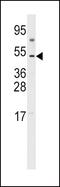 Vascular Endothelial Growth Factor D antibody, PA5-13300, Invitrogen Antibodies, Western Blot image 