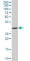 Thioredoxin Related Transmembrane Protein 1 antibody, H00081542-B01P, Novus Biologicals, Western Blot image 