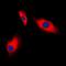 Actin Gamma 2, Smooth Muscle antibody, orb213518, Biorbyt, Immunocytochemistry image 