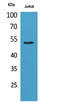 Tubulin alpha-1A chain antibody, STJ96710, St John