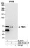 TBC1 Domain Containing Kinase antibody, A305-751A-M, Bethyl Labs, Immunoprecipitation image 