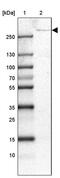 Ubiquitin carboxyl-terminal hydrolase 24 antibody, PA5-55847, Invitrogen Antibodies, Western Blot image 