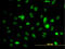 Aurora Kinase A antibody, LS-C133953, Lifespan Biosciences, Immunofluorescence image 