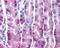 TIMP Metallopeptidase Inhibitor 4 antibody, GTX20075, GeneTex, Immunohistochemistry paraffin image 