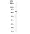 Interleukin 7 Receptor antibody, R32384, NSJ Bioreagents, Western Blot image 