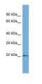 Parvin Gamma antibody, orb326220, Biorbyt, Western Blot image 