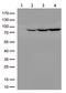 Phosphodiesterase 10A antibody, CF500625, Origene, Western Blot image 