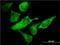 Eukaryotic Translation Initiation Factor 2 Subunit Alpha antibody, H00001965-M01, Novus Biologicals, Immunocytochemistry image 