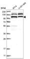 Exocyst Complex Component 4 antibody, NBP2-54921, Novus Biologicals, Western Blot image 