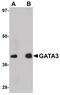 GATA Binding Protein 3 antibody, PA5-20892, Invitrogen Antibodies, Western Blot image 