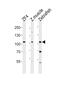 ATP/GTP Binding Protein Like 2 antibody, PA5-72669, Invitrogen Antibodies, Western Blot image 