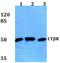 Lymphotoxin Beta Receptor antibody, A00942-1, Boster Biological Technology, Western Blot image 