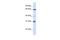 Guanylate Binding Protein 2 antibody, PA5-44204, Invitrogen Antibodies, Western Blot image 