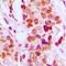 DExD-Box Helicase 52 antibody, LS-C358465, Lifespan Biosciences, Immunohistochemistry frozen image 