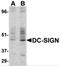 CD209 Molecule antibody, 2347, ProSci, Western Blot image 