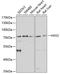 Hyaluronan Synthase 3 antibody, A04910, Boster Biological Technology, Western Blot image 