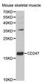 CD247 Molecule antibody, orb48306, Biorbyt, Western Blot image 