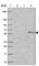 Solute Carrier Family 29 Member 3 antibody, HPA054976, Atlas Antibodies, Western Blot image 