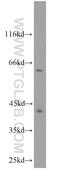 Cyclin Dependent Kinase 9 antibody, 11705-1-AP, Proteintech Group, Western Blot image 