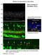 SH3 and multiple ankyrin repeat domains protein 1 antibody, A05690-1, Boster Biological Technology, Immunohistochemistry paraffin image 