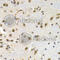 Lamin B Receptor antibody, A5468, ABclonal Technology, Immunohistochemistry paraffin image 