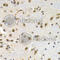 Lamin B Receptor antibody, A5468, ABclonal Technology, Immunohistochemistry paraffin image 