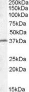 Radial spoke head 1 homolog antibody, PA5-18946, Invitrogen Antibodies, Western Blot image 