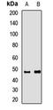 Ras Related GTP Binding D antibody, LS-C668558, Lifespan Biosciences, Western Blot image 