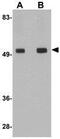 Transmembrane protein 214 antibody, GTX85256, GeneTex, Western Blot image 