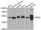 Presenilin 2 antibody, STJ110030, St John