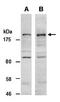 Lysine Demethylase 5C antibody, orb66993, Biorbyt, Western Blot image 