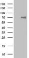 Protein Arginine Methyltransferase 5 antibody, LS-C794060, Lifespan Biosciences, Western Blot image 