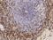 P-selectin glycoprotein ligand 1 antibody, GTX02075, GeneTex, Immunohistochemistry paraffin image 