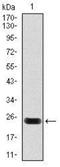 Troponin T2, Cardiac Type antibody, NBP2-37491, Novus Biologicals, Western Blot image 