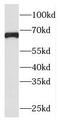 Putative protein PLEKHA9 antibody, FNab06538, FineTest, Western Blot image 