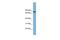 Golgi Associated, Gamma Adaptin Ear Containing, ARF Binding Protein 3 antibody, PA5-44345, Invitrogen Antibodies, Western Blot image 