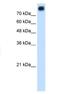 Cadherin 3 antibody, NBP1-59222, Novus Biologicals, Western Blot image 